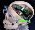 AI will be the future for healthcare