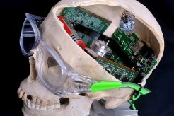 AI will be the future for healthcare